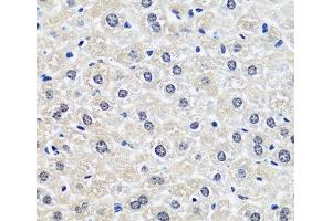 Immunohistochemistry of paraffin-embedded Rat liver using CCDC59 Polyclonal Antibody at dilution of 1:100 (40x lens). (CCDC59 Antikörper)