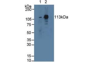 Western blot analysis of (1) Rat Serum and (2) Mouse Lung Tissue. (STAT2 Antikörper  (AA 587-838))