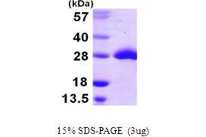 SDS-PAGE (SDS) image for Methionine Sulfoxide Reductase A (MSRA) (AA 1-212) protein (His tag) (ABIN7279422) (MSRA Protein (AA 1-212) (His tag))