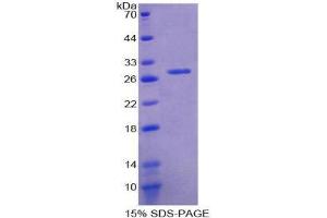 SDS-PAGE (SDS) image for Glutathione S-Transferase theta 2 (GSTT2) (AA 16-242) protein (His tag) (ABIN2125035) (GSTT2 Protein (AA 16-242) (His tag))