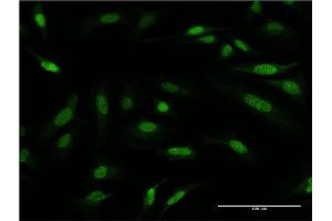 Immunofluorescence (IF) image for anti-Protein Arginine Methyltransferase 6 (PRMT6) (AA 1-316) antibody (ABIN949428)