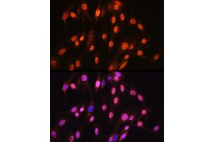 Immunofluorescence analysis of C6 cells using SOX10 Rabbit mAb (ABIN7270566) at dilution of 1:100 (40x lens). (SOX10 Antikörper)