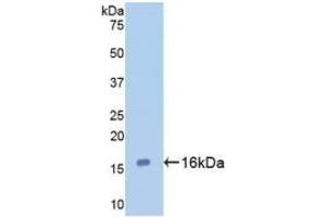 Detection of Recombinant GAL7, Human using Monoclonal Antibody to Galectin 7 (GAL7) (LGALS7 Antikörper  (AA 1-136))