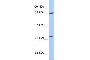 WB Suggested Anti-PBK Antibody Titration:  0. (PBK Antikörper  (N-Term))