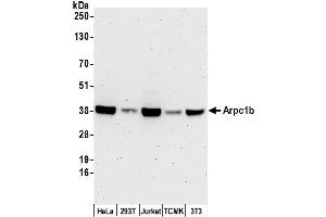 Western Blotting (WB) image for anti-Actin Related Protein 2/3 Complex, Subunit 1B, 41kDa (ARPC1B) (AA 272-322) antibody (ABIN7449980)