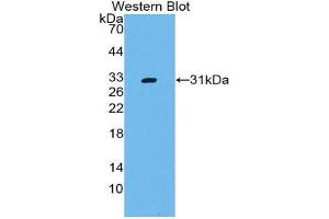 Western Blotting (WB) image for anti-CD109 (CD109) (AA 719-965) antibody (ABIN2119840) (CD109 Antikörper  (AA 719-965))