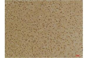 Immunohistochemistry (IHC) analysis of paraffin-embedded Mouse Brain Tissue using GABA A Receptor gamma2 Rabbit Polyclonal Antibody diluted at 1:200. (GABRG2 Antikörper)