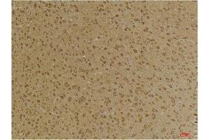 Immunohistochemistry (IHC) analysis of paraffin-embedded Mouse Brain Tissue using GABA A Receptor gamma2 Rabbit Polyclonal Antibody diluted at 1:200.