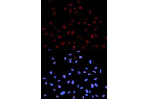 Immunofluorescence (IF) image for anti-Met Proto-Oncogene (MET) (pTyr1235) antibody (ABIN1870439) (c-MET Antikörper  (pTyr1235))