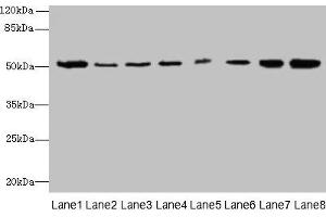 Western blot All lanes: PGS1 antibody at 2 μg/mL Lane 1: Mouse liver tissue Lane 2: Hela whole cell lysate Lane 3: Jurkat whole cell lysate Lane 4: HepG2 whole cell lysate Lane 5: THP-1 whole cell lysate Lane 6: Mouse spleen tissue Lane 7: Mouse thymus tissue Lane 8: Mouse kidney tissue Secondary Goat polyclonal to rabbit IgG at 1/10000 dilution Predicted band size: 63, 52, 38, 6 kDa Observed band size: 52 kDa (PGS1 Antikörper  (AA 110-400))