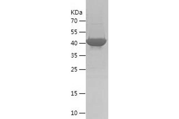 Bcl-2 Protein (AA 1-211) (His-IF2DI Tag)