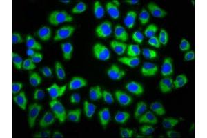 Immunofluorescence staining of Hela cells with ABIN7154478 at 1:133, counter-stained with DAPI. (GAS1 Antikörper  (AA 248-318))