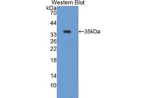 Western Blotting (WB) image for anti-Protein Kinase C, beta 1 (Pkc beta 1) (AA 342-600) antibody (ABIN2118925) (Pkc beta 1 Antikörper  (AA 342-600))