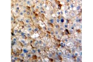 Used in DAB staining on fromalin fixed paraffin-embedded Liver tissue (IGSF1 Antikörper  (AA 1008-1227))
