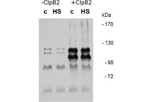 Image no. 2 for anti-ClpB2 Gene Product (CLPB2) antibody (ABIN334578) (CLPB2 Antikörper)