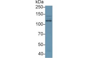 Western blot analysis of Human HeLa cell lysate, using Human PIK3Cb Antibody (1 µg/ml) and HRP-conjugated Goat Anti-Rabbit antibody ( (PIK3CB Antikörper  (AA 524-703))