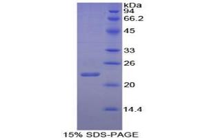 SDS-PAGE analysis of Goat Interleukin 1 alpha Protein. (IL1A Protein)