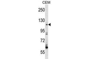 ARHGEF1 Antibody (N-term) western blot analysis in CEM cell line lysates (35µg/lane).