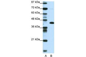 WB Suggested Anti-ZBTB25 Antibody Titration:  0. (ZBTB25 Antikörper  (Middle Region))
