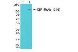 Western blot analysis of extracts from 293 cells (Lane 2), using IGF1R (Ab-1346) antiobdy. (IGF1R Antikörper  (Tyr1346))