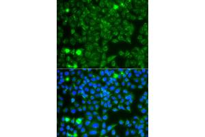 Immunofluorescence analysis of A549 cell using GBA3 antibody. (GBA3 Antikörper)