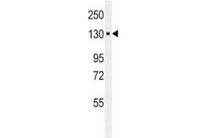 Western Blotting (WB) image for anti-Integrin, alpha 6 (ITGA6) antibody (ABIN3029807)