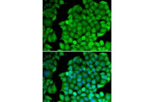 Immunofluorescence (IF) image for anti-Cyclin D2 (CCND2) antibody (ABIN1875413) (Cyclin D2 Antikörper)