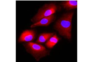 Immunofluorescence of human A549 cells stained with Hoechst 33342 (Blue) and monoclonal anti-human FUS2 antibody (1:500) with Texas Red (red). (FUS2/NAA80 (AA 1-308) Antikörper)