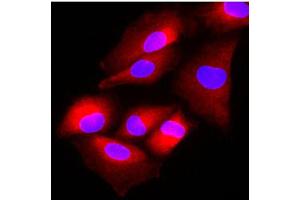 Immunofluorescence of human A549 cells stained with Hoechst 33342 (Blue) and monoclonal anti-human FUS2 antibody (1:500) with Texas Red (red). (NAT6 Antikörper)