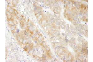anti-Eukaryotic Translation Elongation Factor 1 gamma (EEF1G) (AA 200-250) antibody