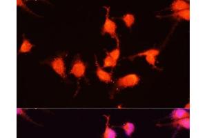 Immunofluorescence analysis of U-251MG cells using NGF Polyclonal Antibody at dilution of 1:100 (40x lens). (Nerve Growth Factor Antikörper)