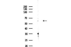 anti-Receptor-Interacting Serine-threonine Kinase 2 (RIPK2) (N-Term) antibody