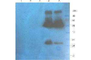 Western Blot using anti-OX40L antibody  Rat spleen (lane 1), rat muscle (lane 2), rat bladder (lane 3), human breast tumour (lane 4) and human thyroid tumour (lane 5) samples were resolved on a 10% SDS PAGE gel and blots probed with  at 1 µg/ml before being detected by a secondary antibody. (Rekombinanter CD40L (Ruplizumab Biosimilar) Antikörper)
