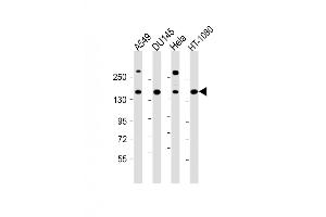 Western Blot at 1:1000 dilution Lane 1: A549 whole cell lysate Lane 2: DU145 whole cell lysate Lane 3: Hela whole cell lysate Lane 4: HT-1080 whole cell lysate Lysates/proteins at 20 ug per lane. (COL4A1 Antikörper  (N-Term))