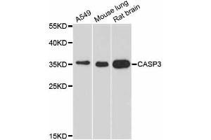 Western blot analysis of extracts of various cell lines, using CASP3 antibody. (Caspase 3 Antikörper  (AA 100-200))