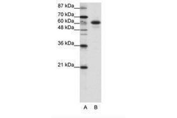 CBLL1 Antikörper  (C-Term)