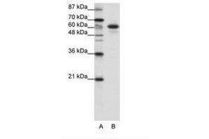 Image no. 1 for anti-Cas-Br-M (Murine) Ecotropic Retroviral Transforming Sequence-Like 1 (CBLL1) (C-Term) antibody (ABIN202651) (CBLL1 Antikörper  (C-Term))