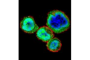Confocal immunofluorescent analysis of RB1 Antibody  (ABIN1881730 and ABIN2840685) with MDA-M cell followed by Alexa Fluor 488-conjugated goat anti-rabbit lgG (green). (Retinoblastoma 1 Antikörper  (AA 586-615))