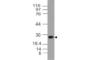 Image no. 1 for anti-14-3-3 theta (YWHAQ) antibody (ABIN5027747) (14-3-3 theta Antikörper)