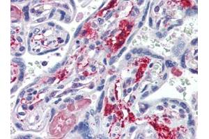 Human Placenta (formalin-fixed, paraffin-embedded) stained with NT5Efollowed by biotinylated goat anti-rabbit IgG secondary antibody, alkaline phosphatase-streptavidin and chromogen. (CD73 Antikörper  (C-Term))
