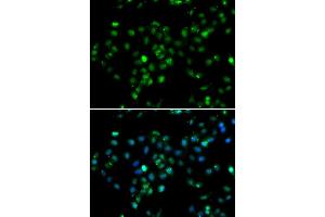 Immunofluorescence analysis of MCF7 cell using RBBP6 antibody.