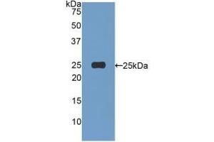 Detection of Recombinant AFM, Human using Polyclonal Antibody to Afamin (AFM) (Afamin Antikörper  (AA 22-210))