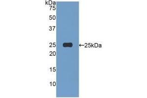 Afamin Antikörper  (AA 22-210)