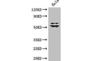 Western Blot Positive WB detected in: Hela whole cell lysate All lanes: KLF5 antibody at 3 μg/mL Secondary Goat polyclonal to rabbit IgG at 1/50000 dilution Predicted band size: 51, 34, 19, 42 kDa Observed band size: 51, 60 kDa (KLF5 Antikörper  (AA 69-346))