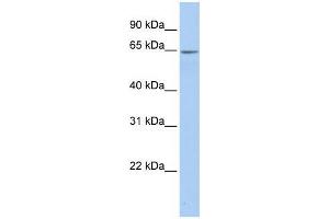 Human Placenta; WB Suggested Anti-ARSE Antibody Titration: 0. (Arylsulfatase E Antikörper  (Middle Region))