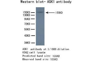 Western Blotting (WB) image for anti-Mitogen-Activated Protein Kinase Kinase Kinase 5 (MAP3K5) antibody (ABIN1873617) (ASK1 Antikörper)