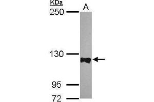 WB Image Sample (30 ug of whole cell lysate) A: HeLa 5% SDS PAGE antibody diluted at 1:5000 (PTPN12 Antikörper  (N-Term))