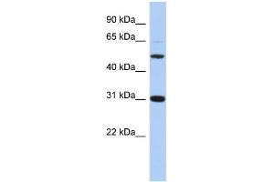 WB Suggested Anti-PI16 Antibody Titration: 0. (PI16 Antikörper  (Middle Region))
