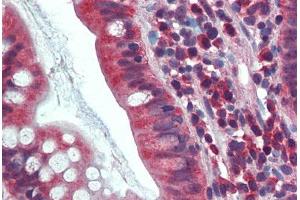 Human Small Intestine: Formalin-Fixed, Paraffin-Embedded (FFPE) (CA1 Antikörper  (AA 166-176))
