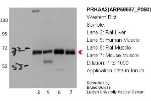 Western Blotting (WB) image for anti-Protein Kinase, AMP-Activated, alpha 2 Catalytic Subunit (PRKAA2) (Middle Region) antibody (ABIN2786849) (PRKAA2 Antikörper  (Middle Region))